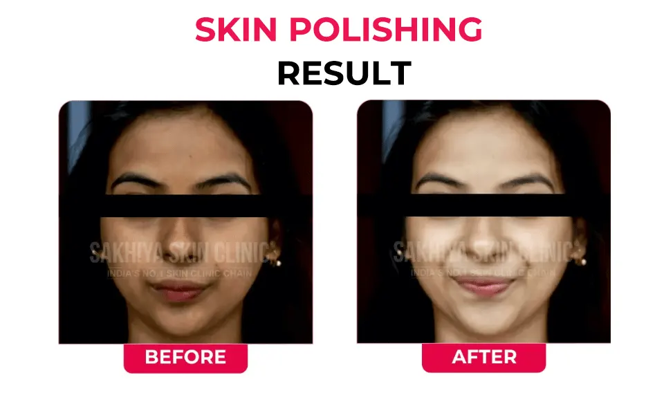 skin-polishing